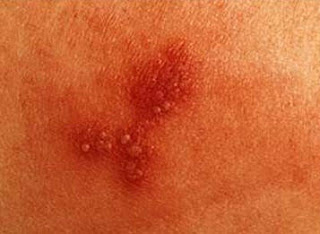 HEALTH AND FITNESS: November 2010