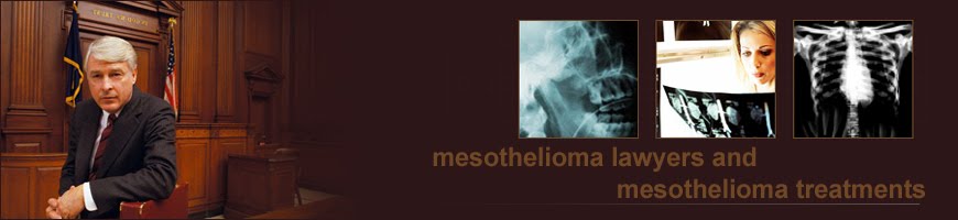 lawyers and law:mesothelioma lawyers,asbestos lawyers,accident injury lawyers