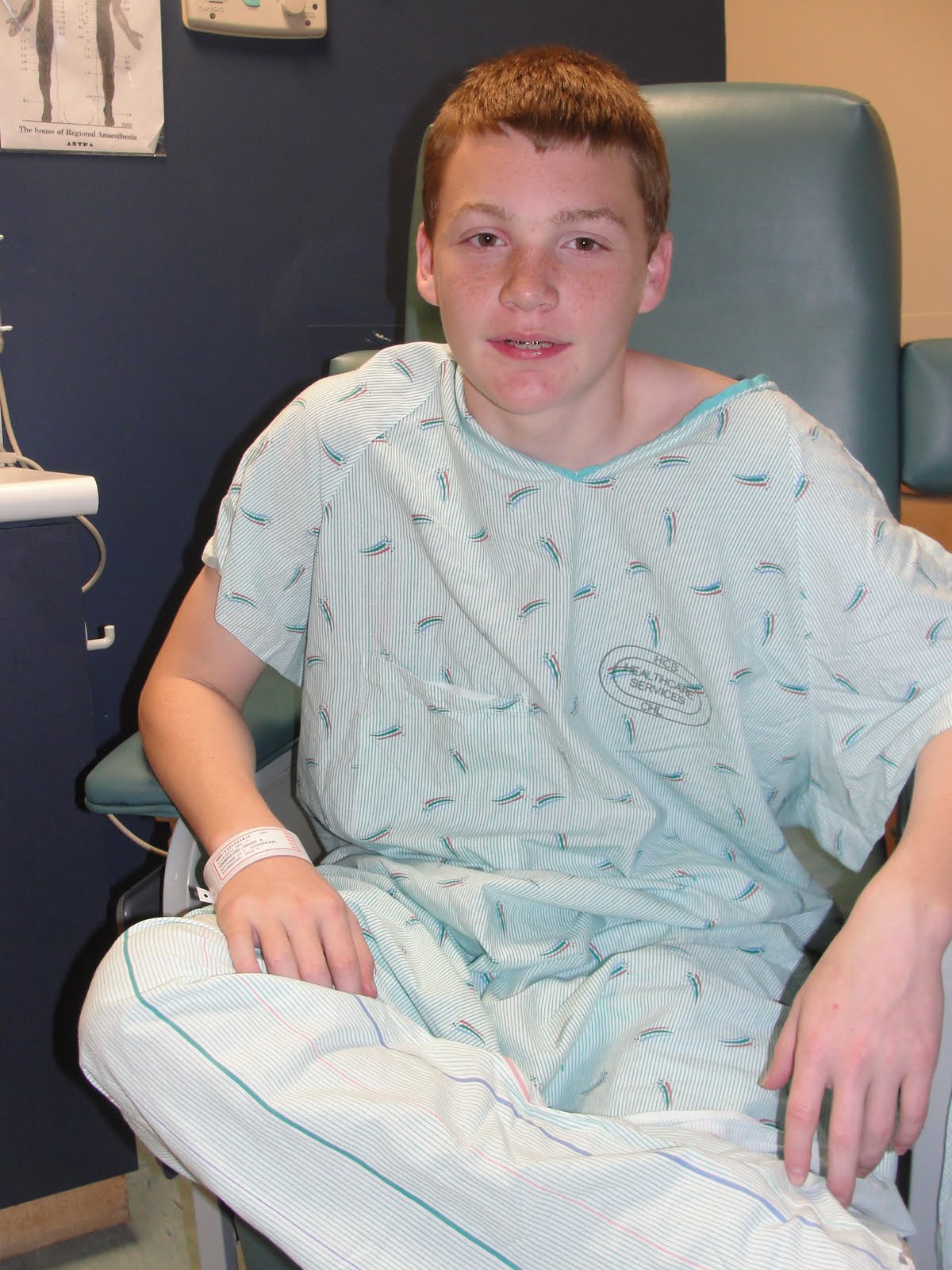The Truth About Edward Hibbert'S Jaw Surgery - rxwc9nq