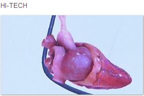 [Inima+artificiala.JPG]