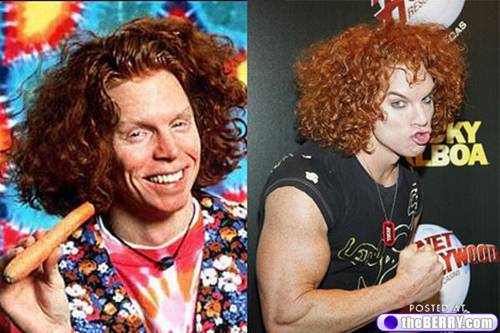 surgery Carrot top facial