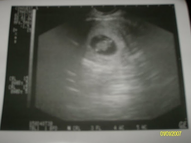 8 Weeks