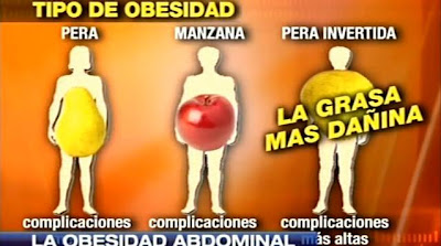 tipos de obesidad