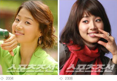 hey hey hey: [ Han Ji Hye ] Before & After Plastic Surgery