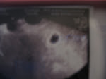 Our Miracle