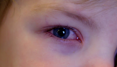 eye pink eyes red look really child 2010 don these his