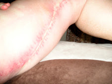 Left Leg