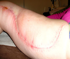 Right Leg