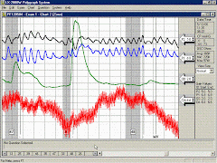 Groseclose Security and Personnel Assessment: What is a polygraph?