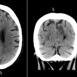 Radiology MRI