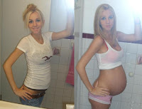 Before and After Pregnancy