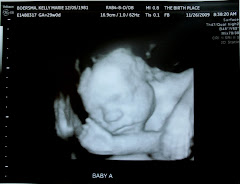 Baby A 29 weeks