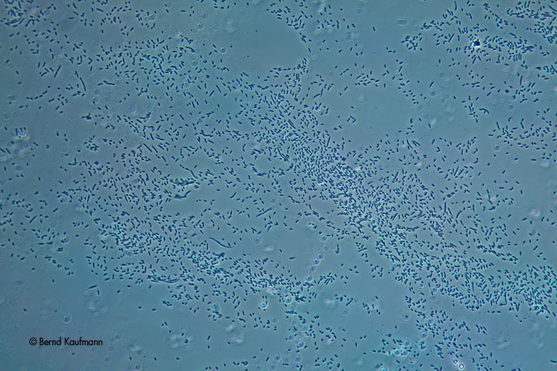 aquamax das Weblog zur Website Fotos des Tages Essigälchen