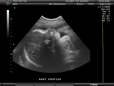 3d Ultrasound Pictures At 29 Weeks | Sylvie Guillems