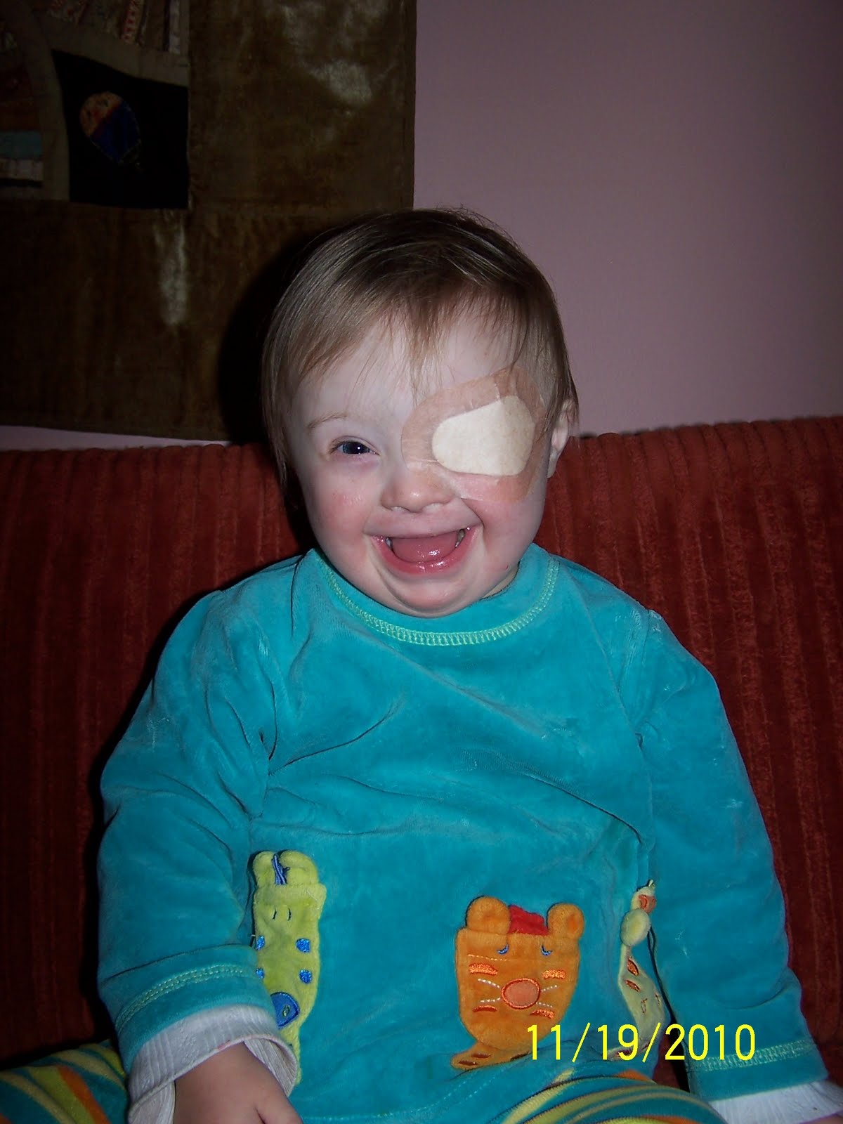 Dancing Through the Tulips Eye Patch and Glasses