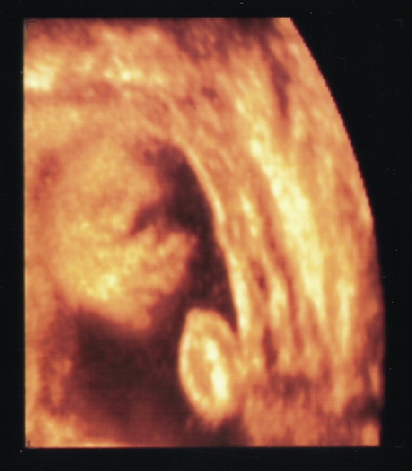 [Scan3d_1.JPG]