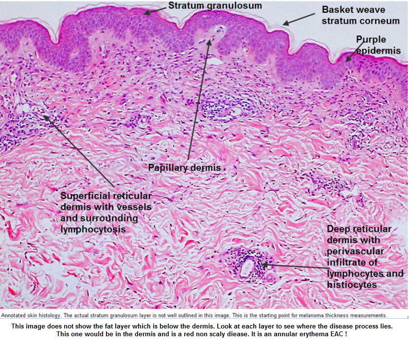 Dermatopathology | DermNet New Zealand