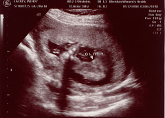 It's A GIRL!