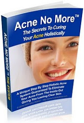 Curing Your Acne Holistically
