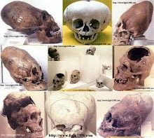 Ancient skulls