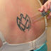 Laser Tattoo Removal   Safely Reduce Eliminate Unwanted