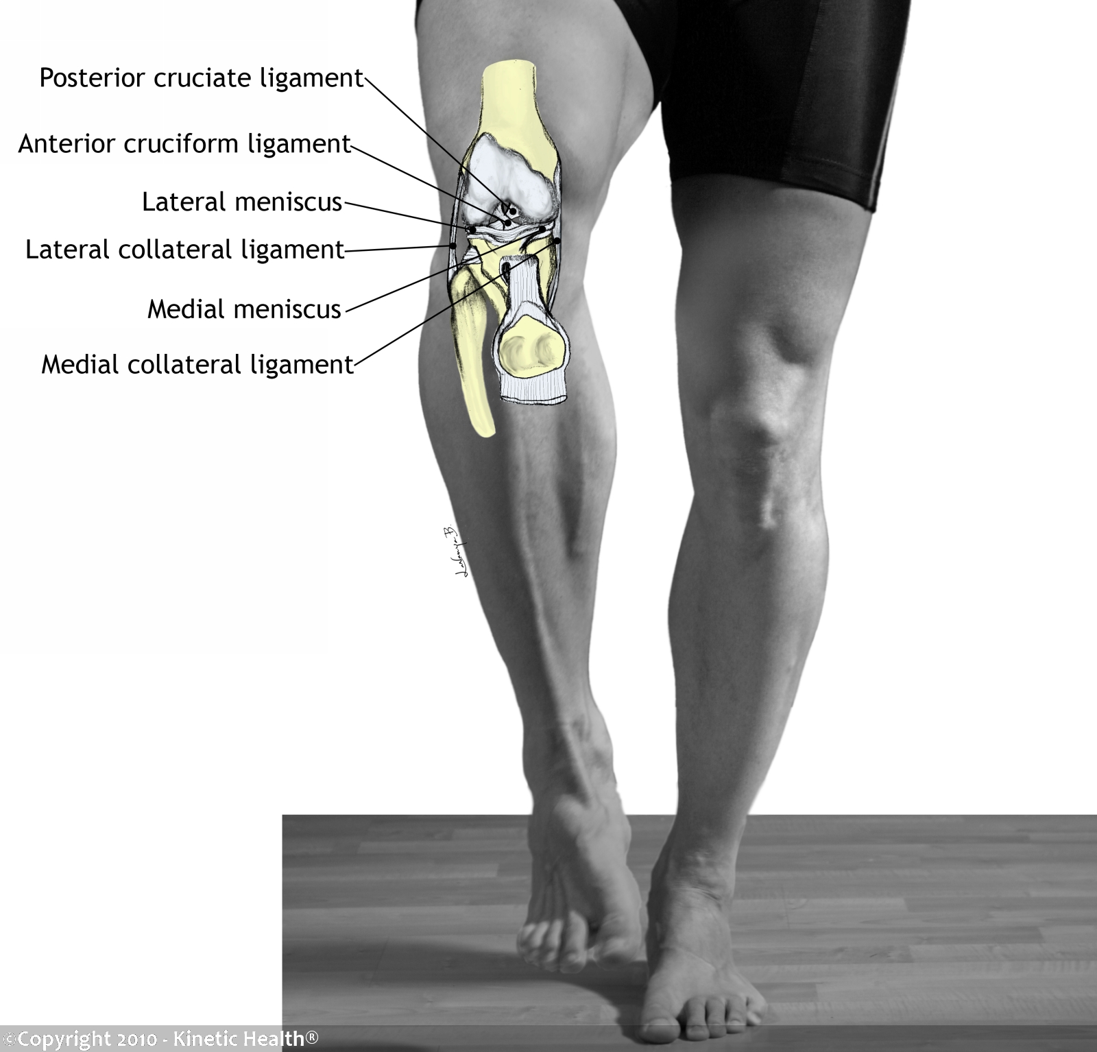 Kinetic Health - Calgary: Ligament Injuries of the Knee