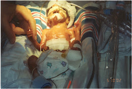 Ryan 2 days old