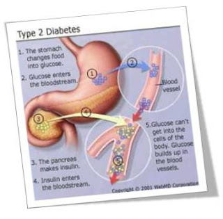 ... de la diabetes mellitus: Fisiopatología de la diabetes mellitus