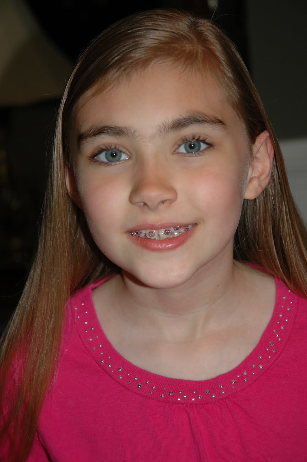 FOUR SISTERS BRACES!!