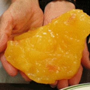 Pictures Of Human Fat 28