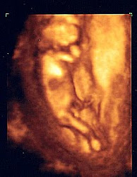 Baby 13 weeks