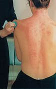 gua sha