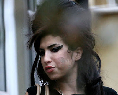 DIRTY-TRUTH: AMY WINEHOUSE DIAGNOSED WITH SKIN DECEASE