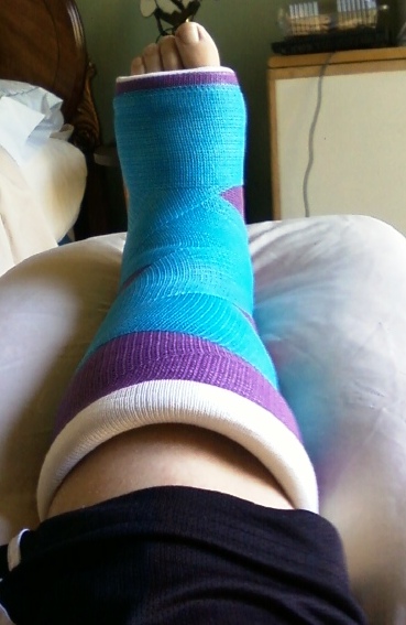 Total Ankle Replacement Surgery: My Experience: FIRST POST-SURGICAL ...