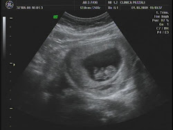 Nosso bebe no dia 05/10/09