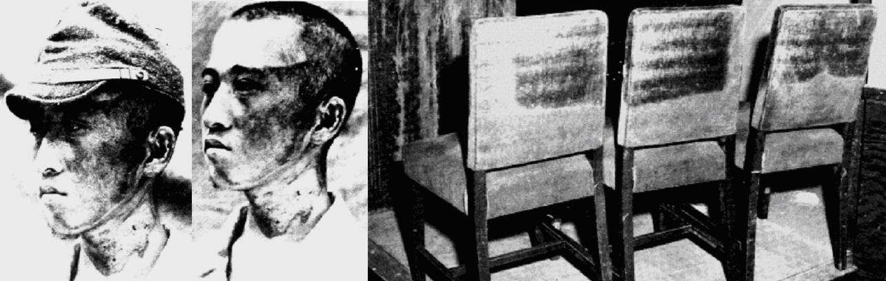 [Line+of+sight+burns+Hiroshima.JPG]