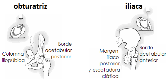 11:50: PROYECCIONES ESPECIALES DE PELVIS