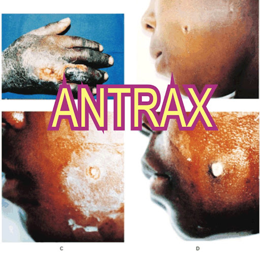 Antrax Antrax