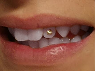 johanna andersson: tandsmycke