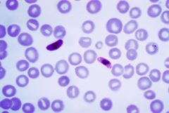 [240px-Plasmodium_falciparum_01.png]