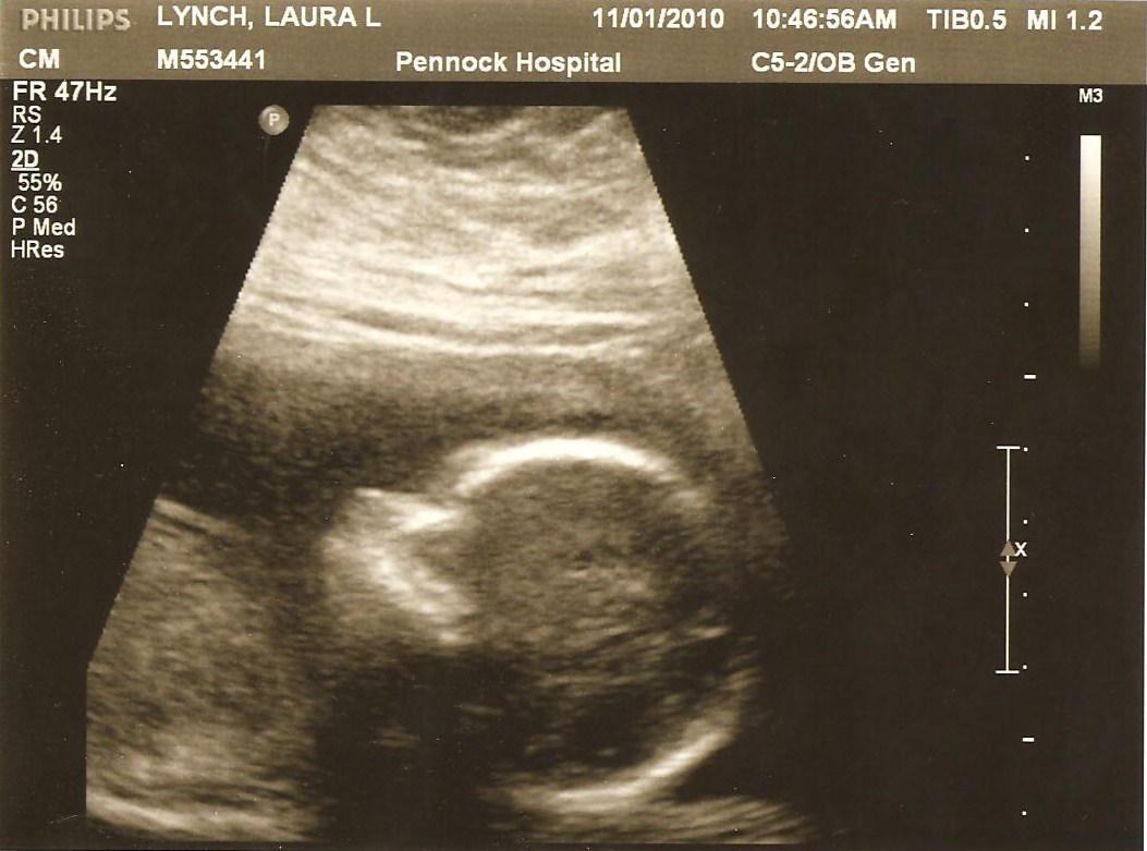 From Bean 2 Baby 19 Week Ultrasound Pictures from-bean-2-baby-19-week-ultrasound-pictures