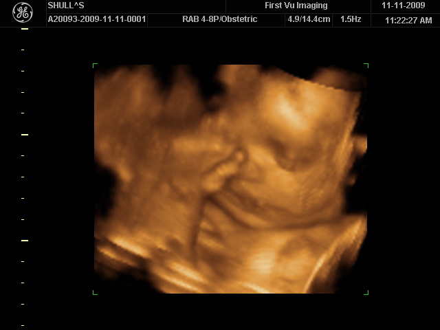 [BABY]