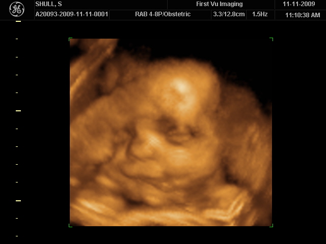 [BABY]