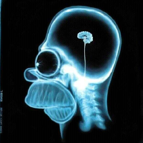 homer_simpson_xray.jpg homer_simpson_xray.jpg