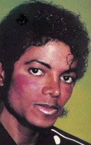 [Michael+vitiligo+5.jpg]