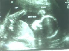 Baby Emmel Week 20