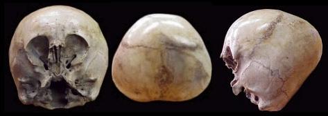 [starchild_skull2.jpg]