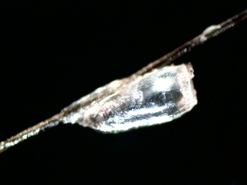 A travers le microscope d'Eyal: Des insectes sur la tête