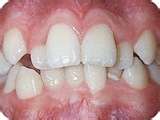 This Is Too Many Teeth!