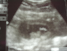 9 week 1 day US